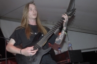 VULVODYNIA